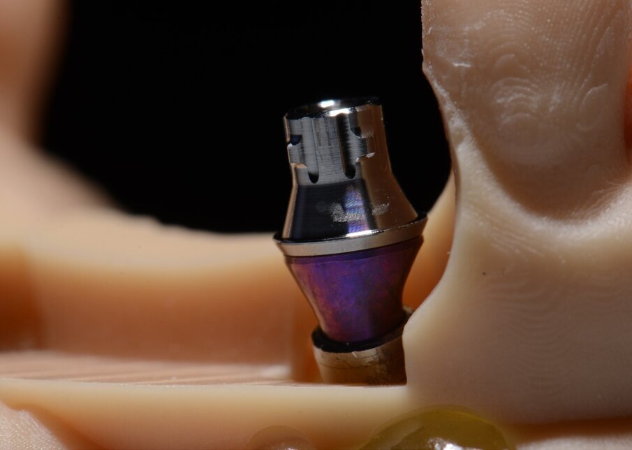 Fig. 51 - SRA e variobase.