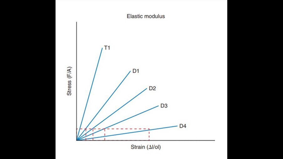 Fig. 5_Variazione della elasticità dell’osso al variare della sua densità secondo la classificazione di Misch.