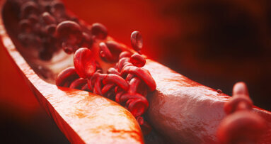 Mundgesundheit beeinflusst Herzgesundheit