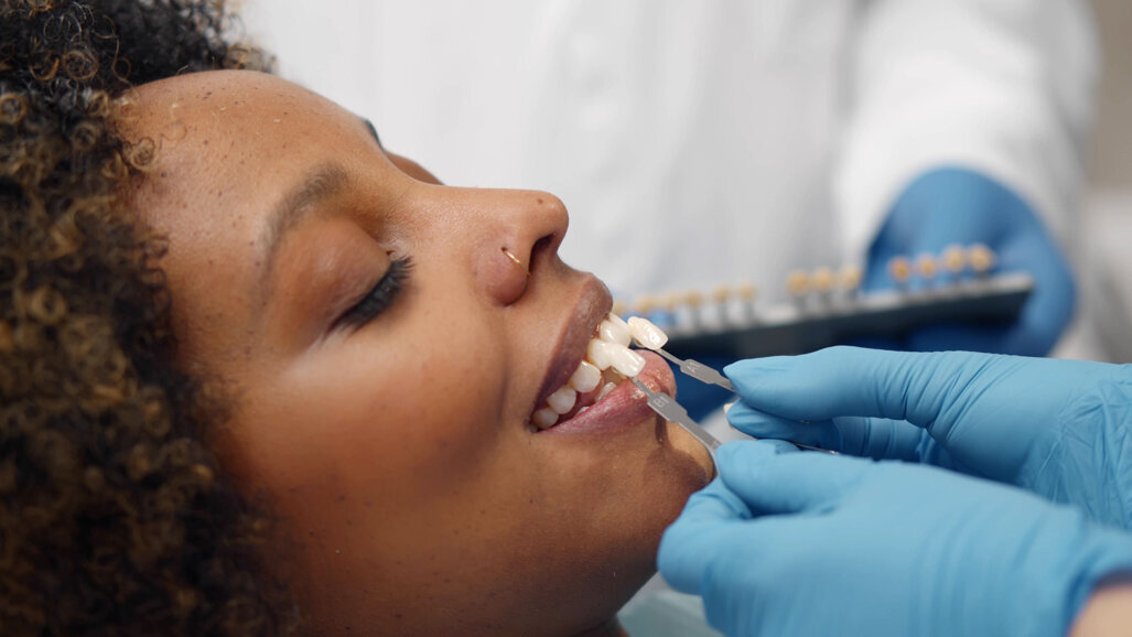 Align Technology introduces its first professional whitening system in the UK