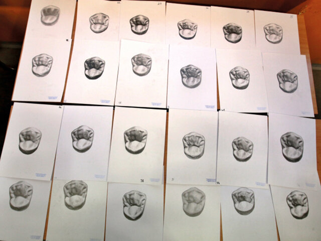 V první části čekal porotce, pana Antonína Skokana, zubního technika z Prahy, pana Daniela Černého, zubního technika z Prahy, paní Ivu Machkovou, zástupkyni společnosti Medent Ústí nad Labem, pana Michala Nového, zubního technika a obchodního poradce firmy Interdent Praha a pana Miroslava Poláka, zubního technika z Chironax s.r.o. Ústí nad Labem, nelehký úkol – vybrat nejvydařenější kresbu horního premoláru.