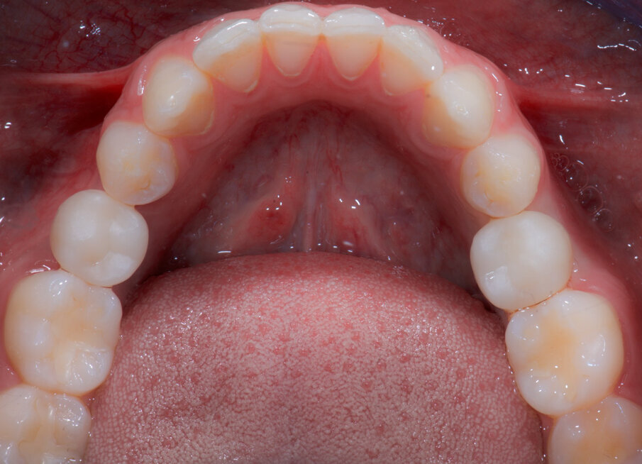 Fig. 12b_La prova dei restauri nella fase di prefinitura.