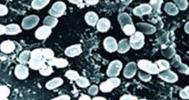 Sodobne tehnike oralne higiene