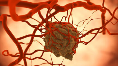 Kampagne der EHNS gegen Kopf-Hals-Krebs