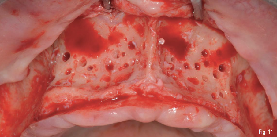 Fig. 11