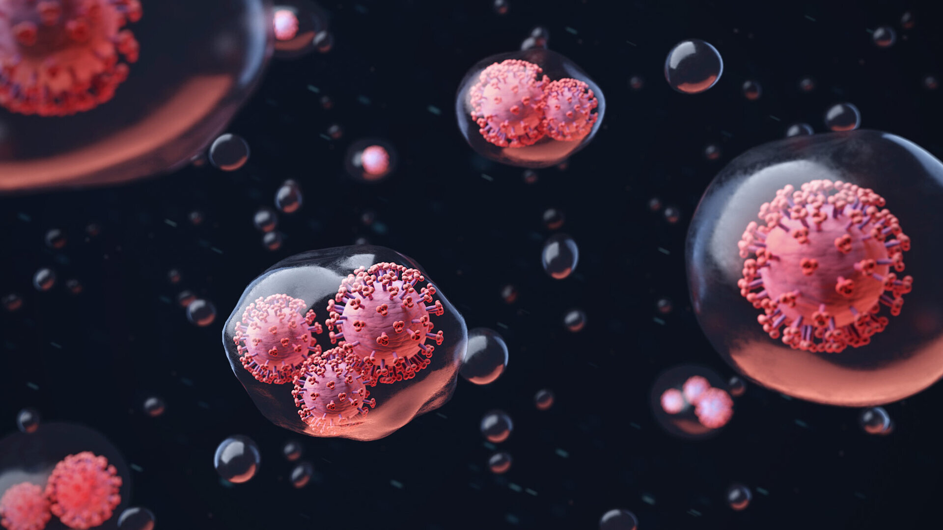 Reducing aerosol viral load to minimise spread of SARS-CoV-2 in dental clinics