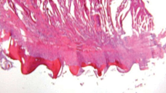 Why you’re missing out if you’re avoiding the use of mini-implants