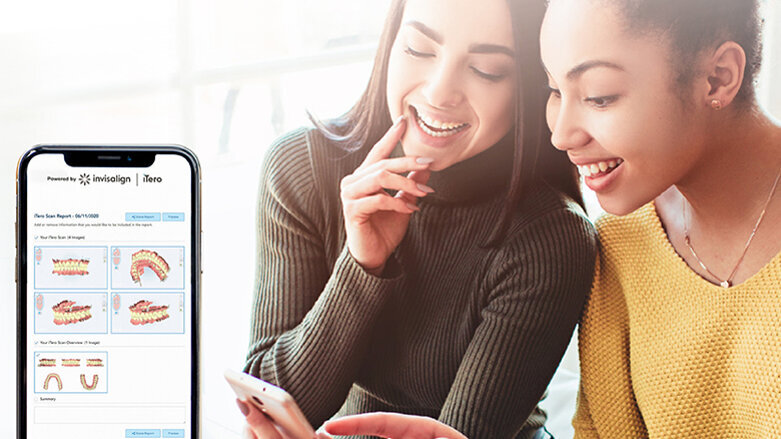 Align Technology objavio softver iTero Workflow 2.0