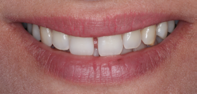 Fig. 1: Preoperative extraoral view of the patient