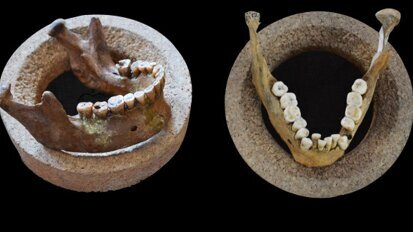 Study finds even earliest farmers had malocclusion