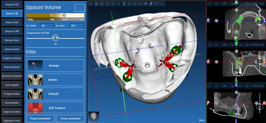Figg. 19, 20_Progettazione Cad con software Realguide.