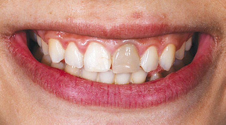 Slika 3.a Usporedba početne situacije 2015. i 2019.