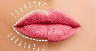 New study examines impact of lip size on facial attractiveness