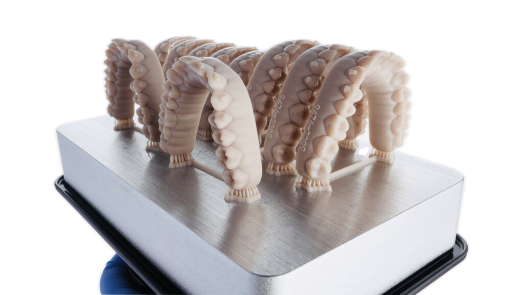 Aesthetic treatment with in-house aligners