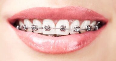 Boetes bij verkeerd titelgebruik orthodontie