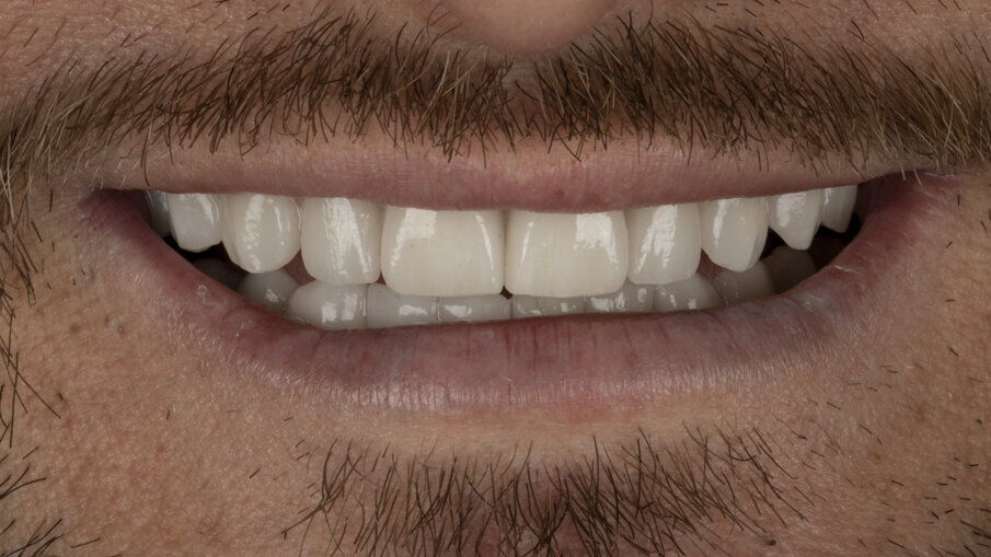 Figg. 10-12 - Fotografie finali.