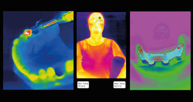 Dental Thermal App offers “a simple, yet intuitive, clinically based workflow”