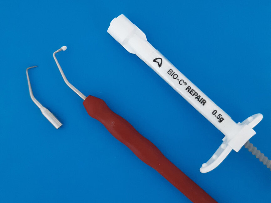 Fig. 3: Ultrasonic tip for root-end treatment and Bio-C Repair cement at the tip of the surgical plugger.