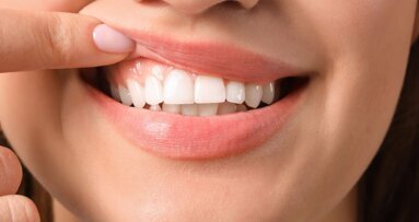 12 mei Dag van het Tandvlees. Doet je praktijk ook mee?