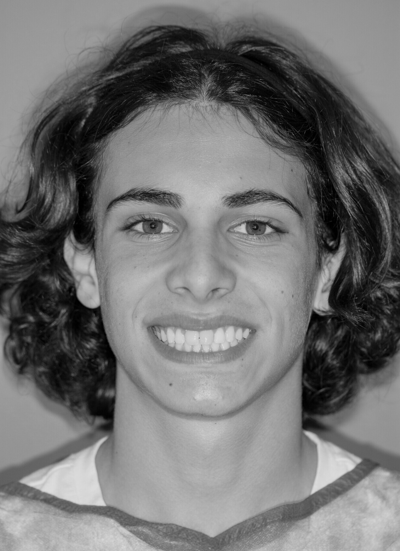 Sourire du patient avant.