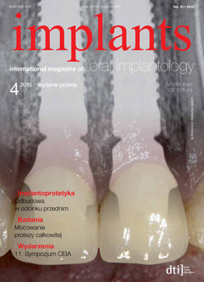 implants Poland No. 4, 2015 implants Poland No. 4, 2015