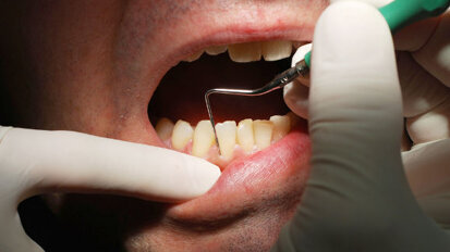 Large number of Brits unaware of consequences of poor oral health