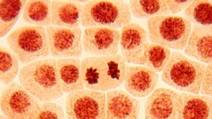 Une découverte génétique pourrait prévenir la récidive du cancer