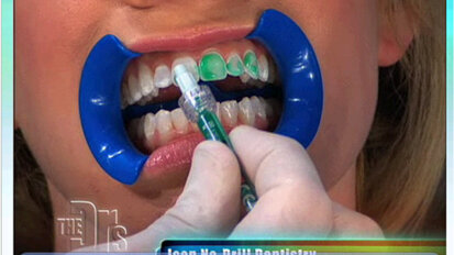 New dental treatment is featured on TV program