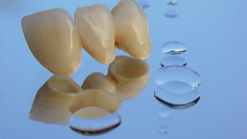 Ein Welser Zahntechnikermeister geht neue Wege