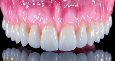 Korony pełnokonturowe – prosty i szybki sposób wykonywania estetycznych prac ceramicznych