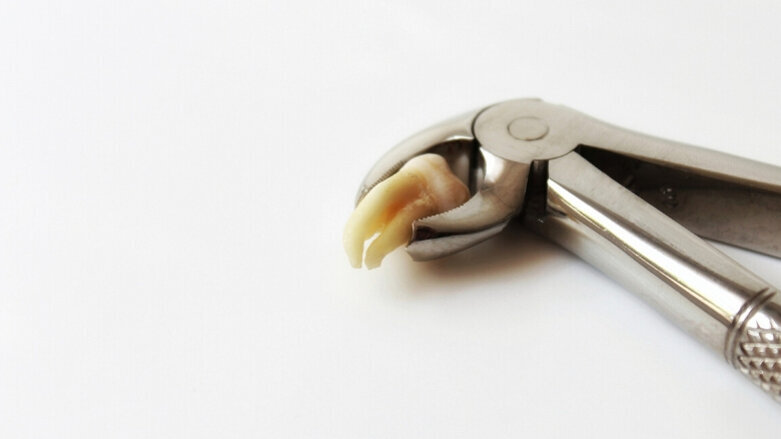 Het KIMO stelt nieuwe richtlijn ‘Derde Molaar’ beschikbaar