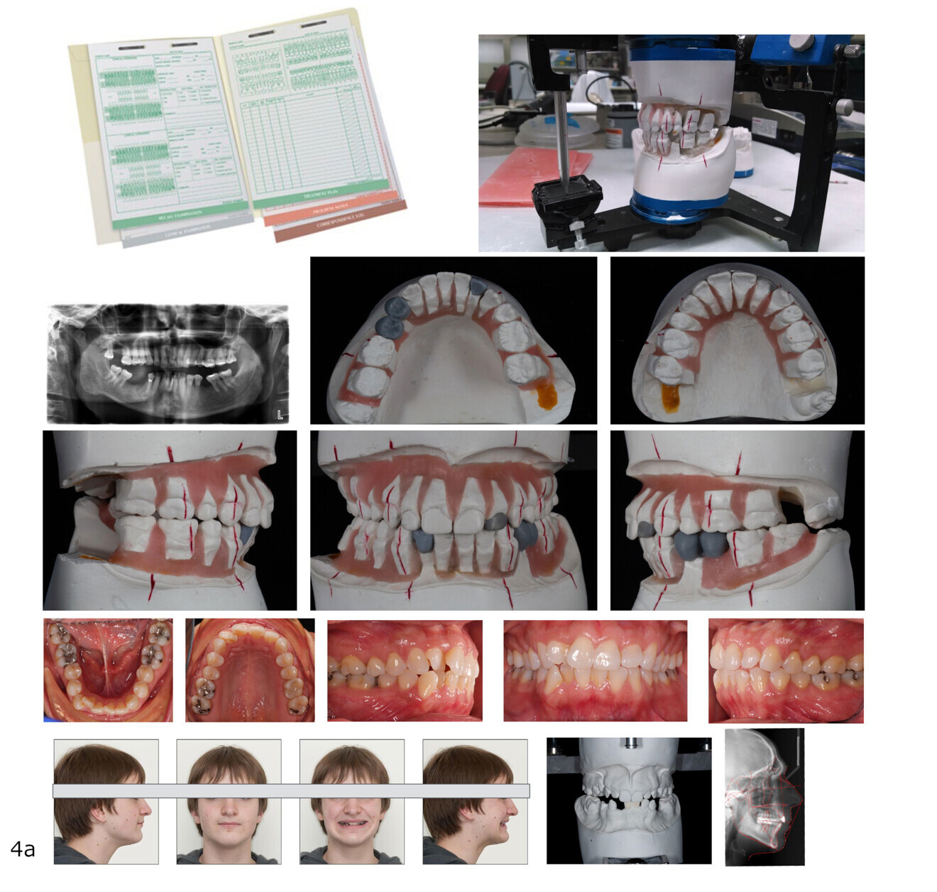Fig. 4a: Contrasting traditional and modern communication approaches in interdisciplinary teams. Traditional approach: communication mainly through in-person meetings, often incorporating social events, to review paper charts and physical treatment simulations.