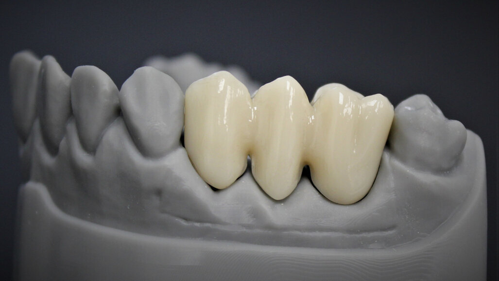 “BEGO is a reliable industry partner in all respects”