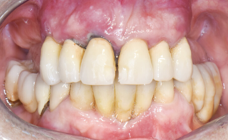 Fig. 1 - Caso iniziale.