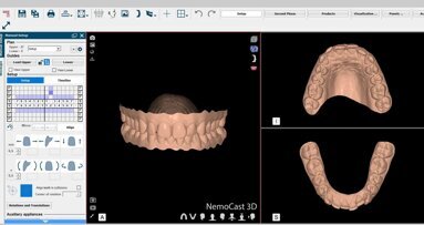 La planificación digital de la Ortodoncia en el Máster de USC