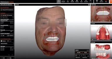¿Sabes cómo elegir un CAD/CAM?