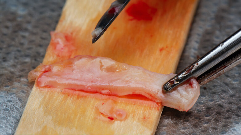 Perio Master Clinic 2022 conference to be held in Mexico