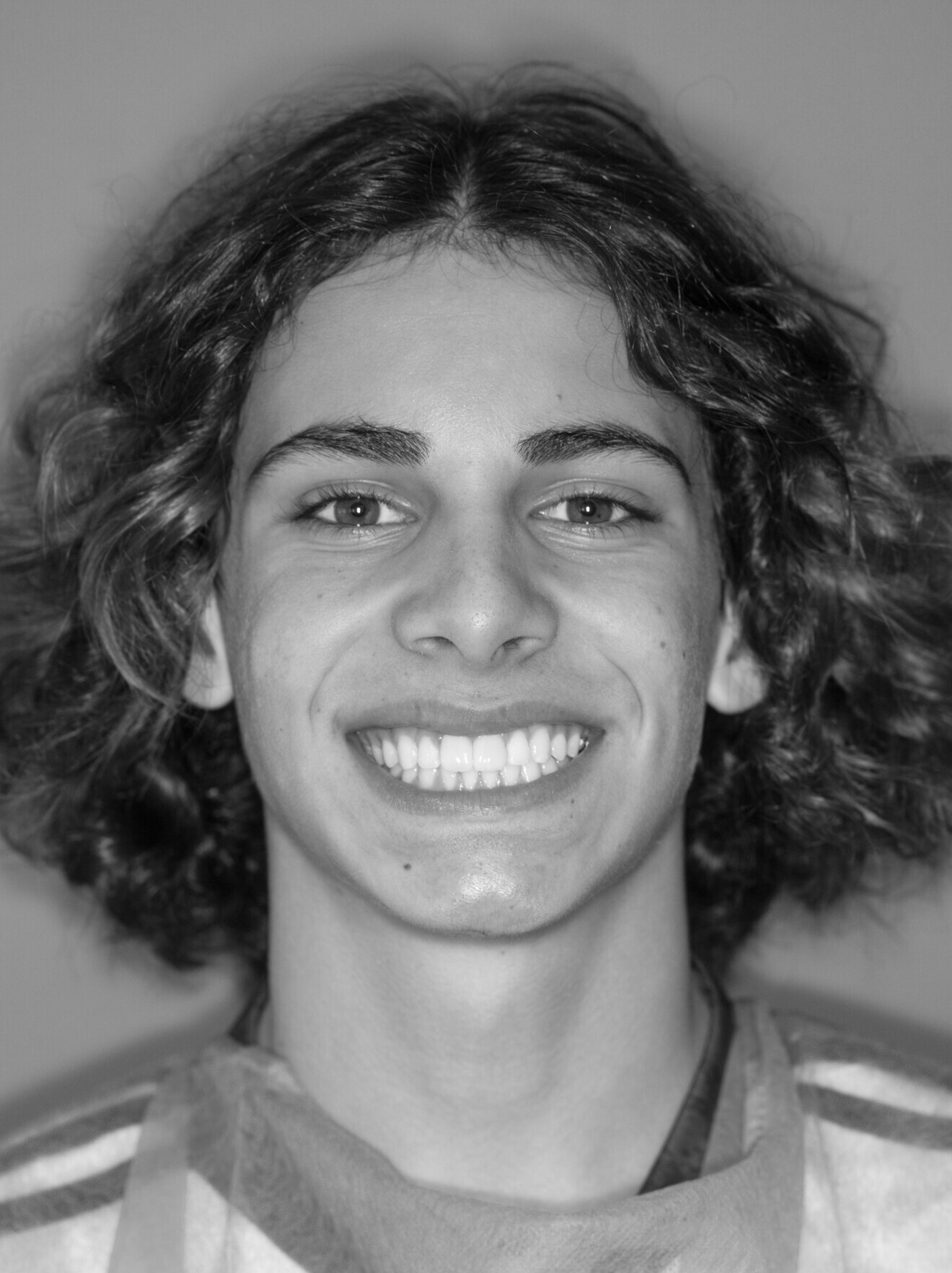 Sourire du patient après.