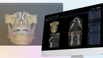 First FDA clearance granted for AI platform analyzing both 2D and 3D dental images