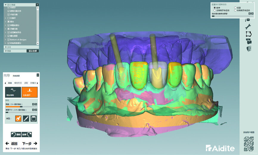 Fig. 37: Design of the abutment.
