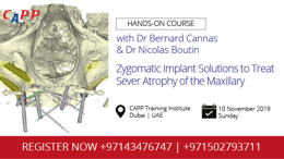 Zygomatic Implant Solutions to Treat Sever Atrophy of the Maxillary