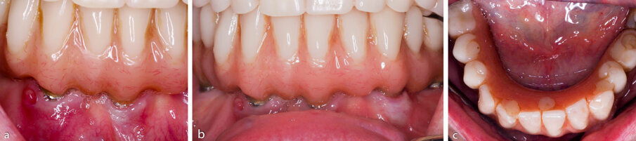 Figure 2a-c. Pre-operative clinical photographs.