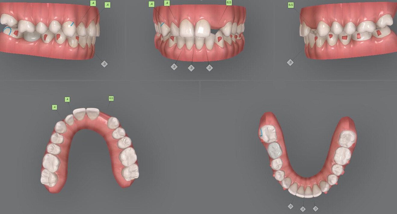 Fig. 5: The approved initial treatment plan.