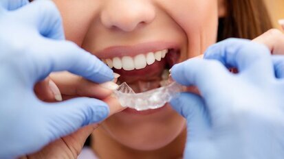 Интервю: Лечението с алайнери става все по-добро