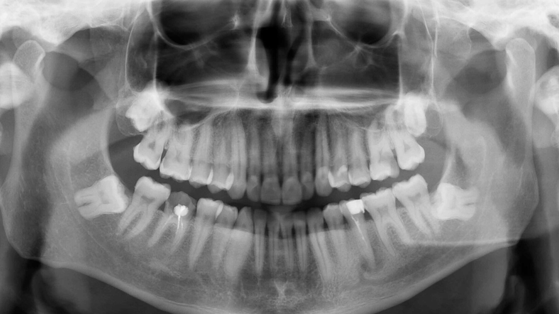 On the pulse of endodontics—the key role of new technologies in root canal therapy