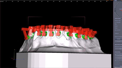 Polorto – IPA – Individually Projected Appliances – Interdisciplinary Treatment