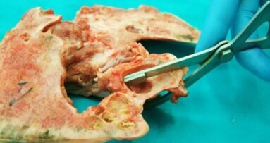 Przyczyny perforacji błony Schneidera podczas podnoszenia dna zatoki szczękowej metodą zamkniętą