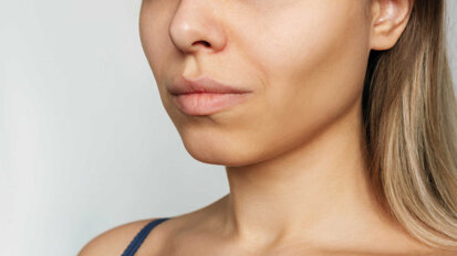 La bichectomie à visée esthétique