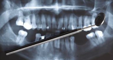 Stimulation von Knochengewebe durch Zahnschmelz-Protein