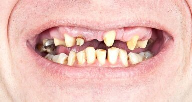 Polacy nie uzupełniają swoich ubytków